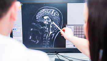 Brain Injury