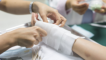 Burn Injury