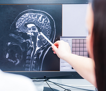 Brain-Injury